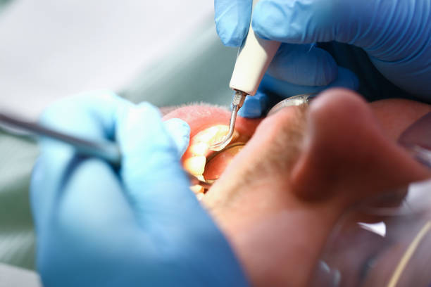 Best Emergency Dental Care for Abscessed Tooth in Winfield, WV