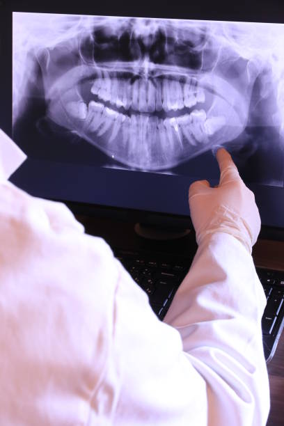 Best Emergency Dentist for Lost Fillings or Crowns in Winfield, WV