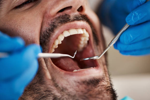 Best Emergency Dental Extractions in Winfield, WV